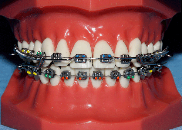 Orthodontic cephalometry
