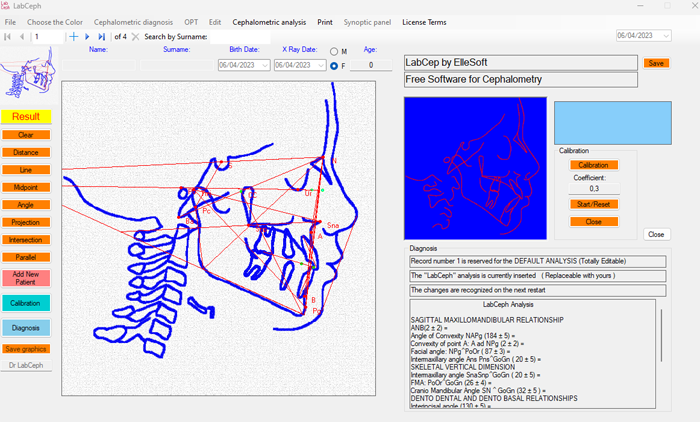 Pree software for cephalometry