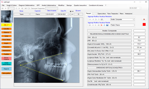 Cefalometria e ortodonzia